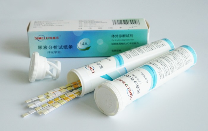 Chemical Urinalysis Strips